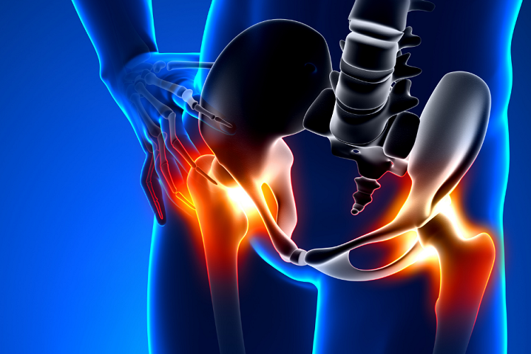 La nevralgia del nervo pudendo..quanto ne&nbsp;sappiamo??