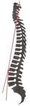 linea-pa-pressione-colonna-vertebrale-postura
