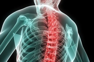 Il latte fermentato riduce il dolore&nbsp;scheletrico?