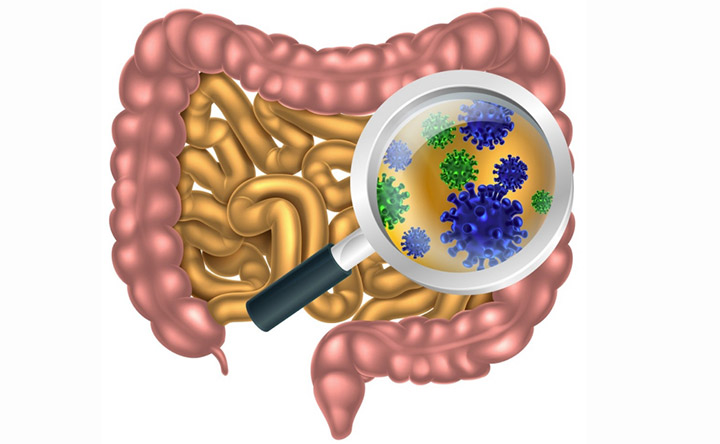 L’acido Gallico e il tumore al&nbsp;colon